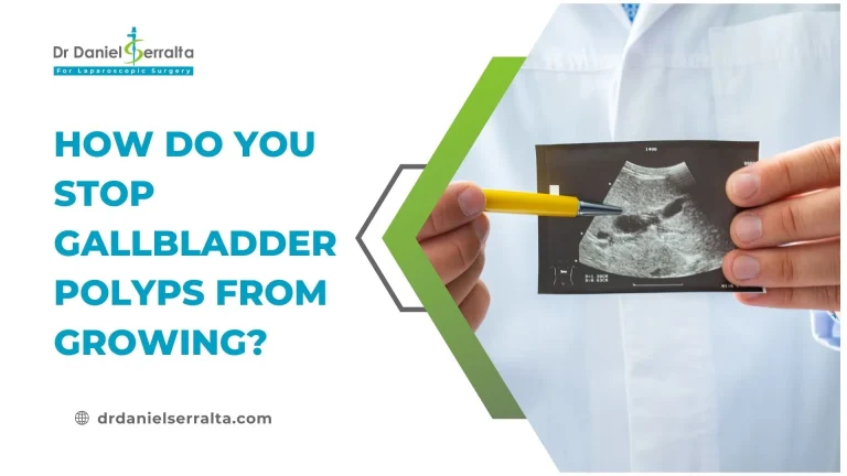 How do you Stop Gallbladder Polyps From Growing?