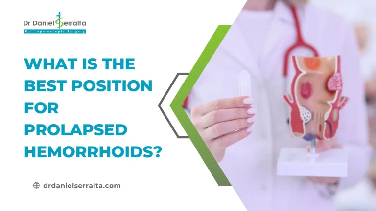 What is the Best Position for Prolapsed Hemorrhoids?