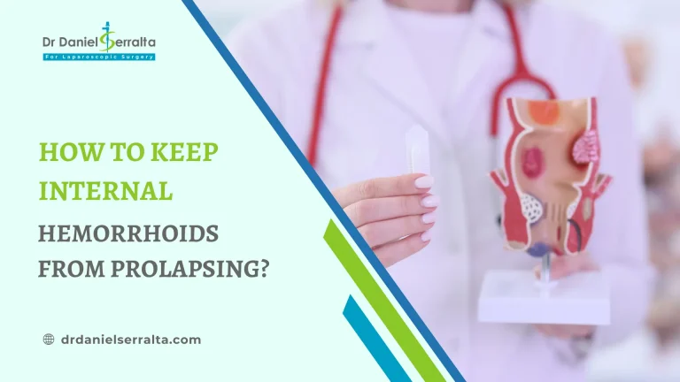 How to Keep Internal Hemorrhoids from Prolapsing?