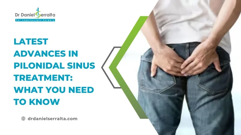 Latest Advances in Pilonidal Sinus Treatment: What You Need to Know