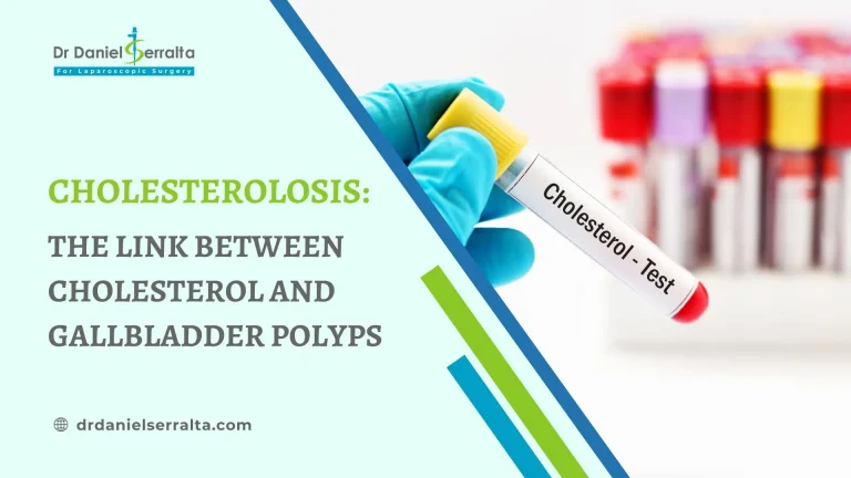Cholesterolosis: The Link Between Cholesterol and Gallbladder Polyps