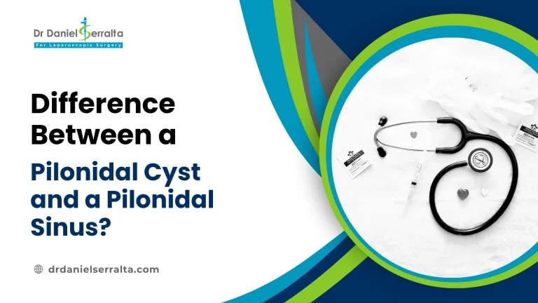 Difference Between a Pilonidal Cyst and a Pilonidal Sinus?
