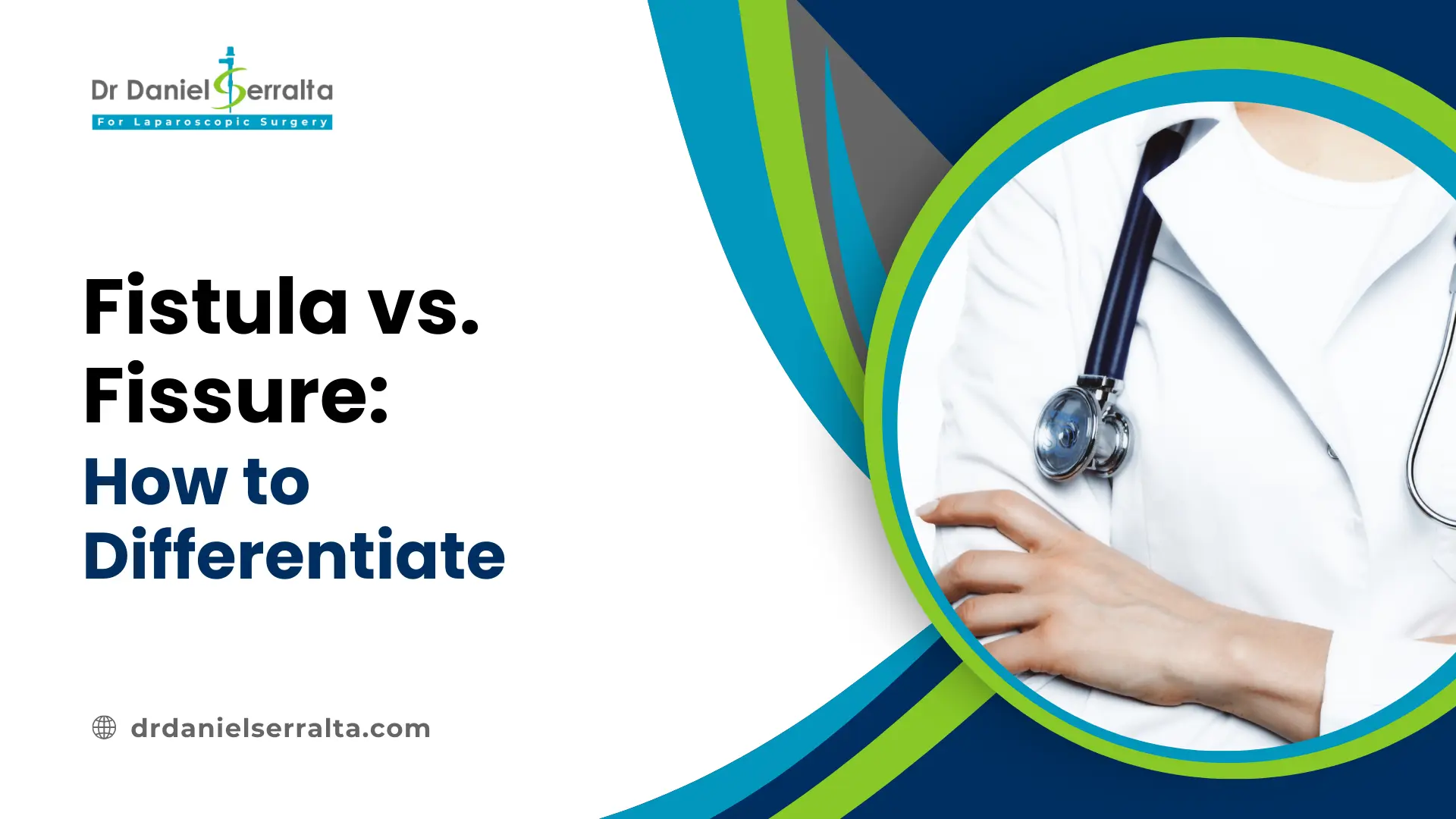 Fistula vs Fissure
