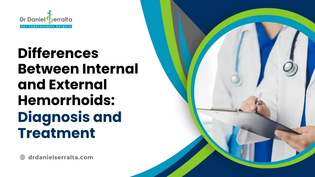 External Hemorrhoids