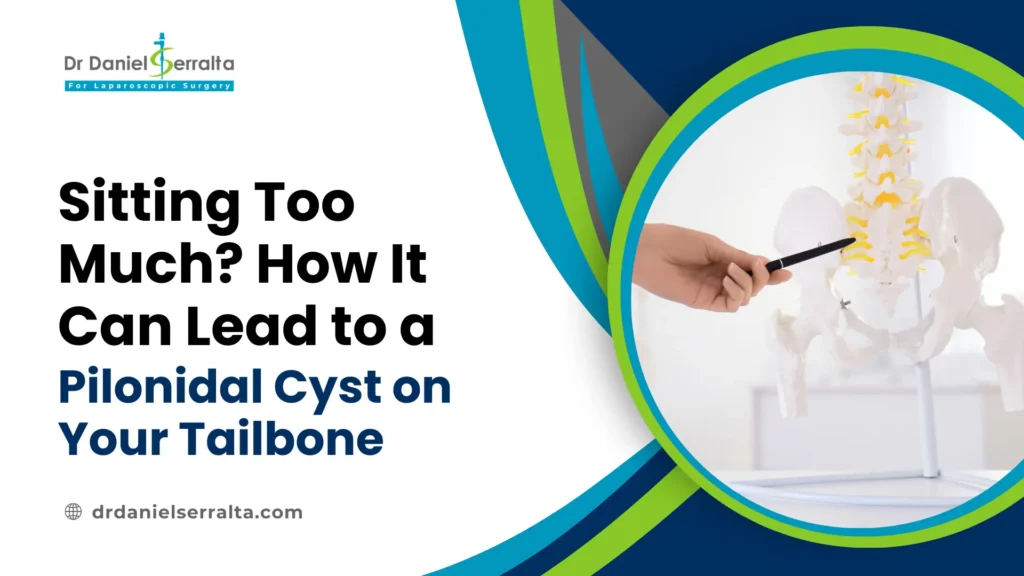 Sitting Too Much? How It Can Lead to a Pilonidal Cyst on Your Tailbone 1 Pilonidal Cyst on Tailbone