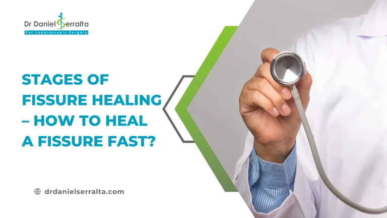 Stages of Fissure Healing – How To Heal a Fissure Fast?