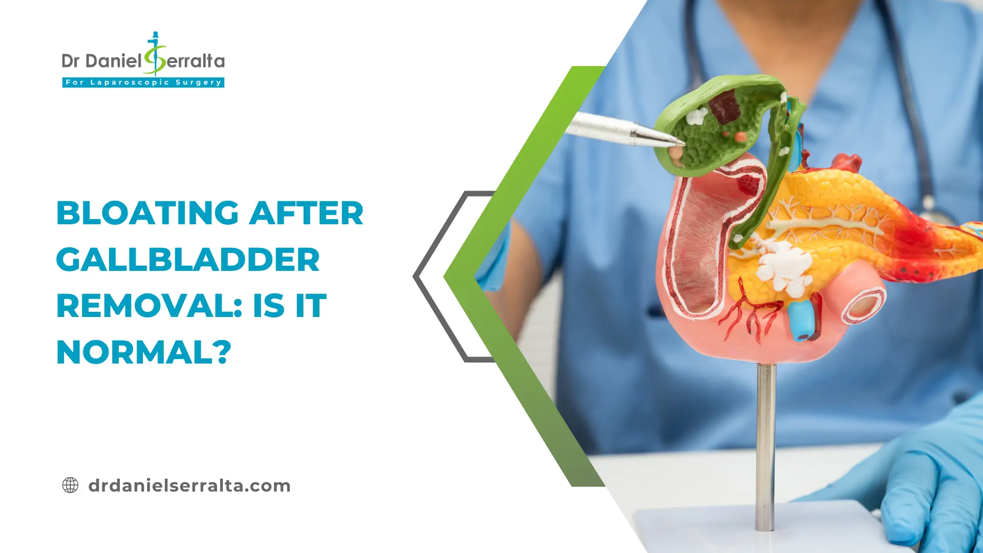 7 Hidden Signs of a Hernia You Shouldn’t Ignore 3 Bloating After Gallbladder Removal