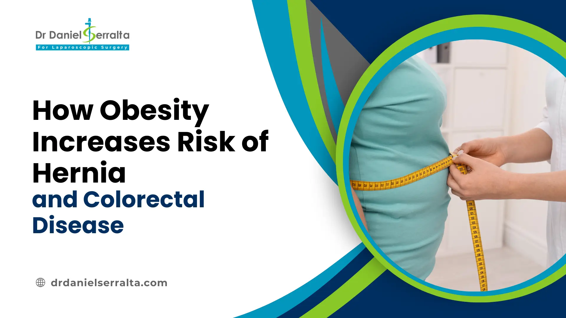 7 Hidden Signs of a Hernia You Shouldn’t Ignore 4 obesity causes hernia