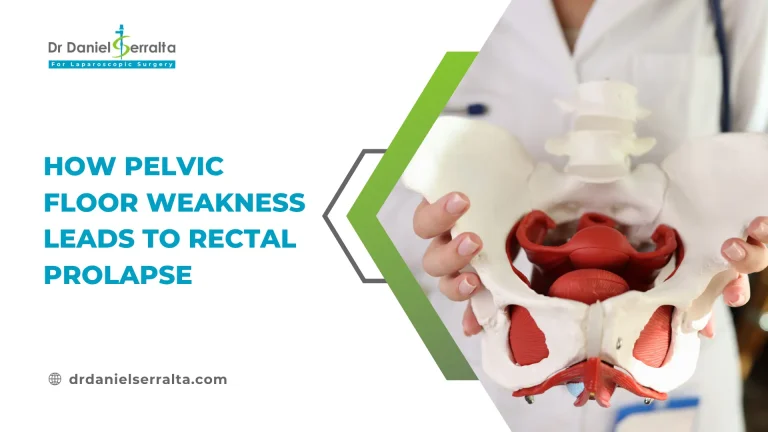 How Pelvic Floor Weakness Leads to Rectal Prolapse