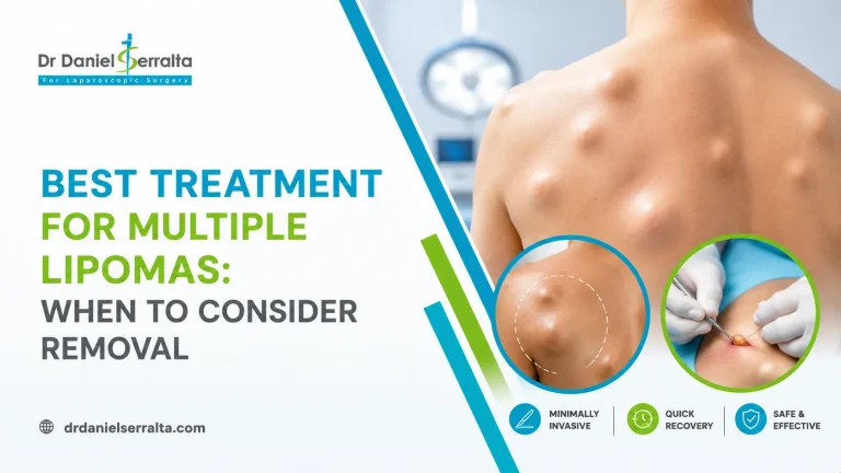 Best Treatment for Multiple Lipomas: When to Consider Removal