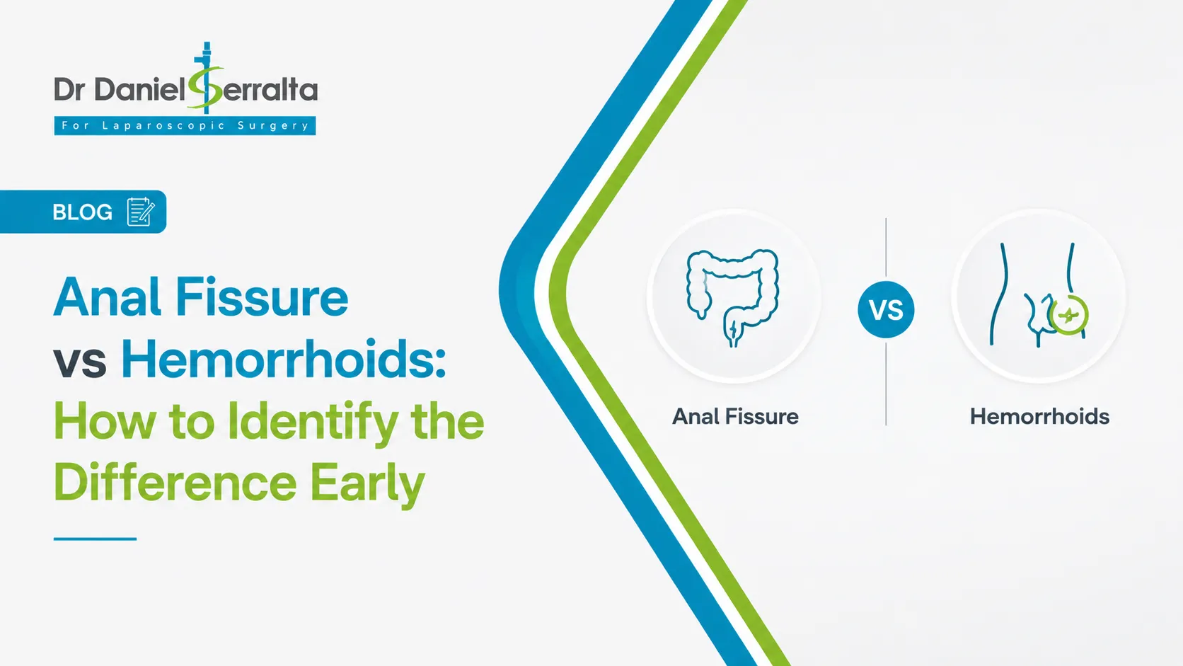 Anal Fissure vs Hemorrhoids