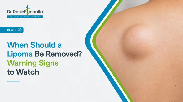 When Should a Lipoma Be Removed? Warning Signs to Watch