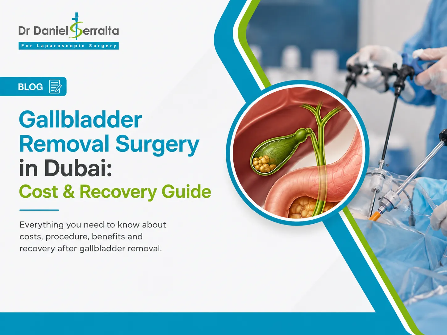 Gallbladder removal in Dubai