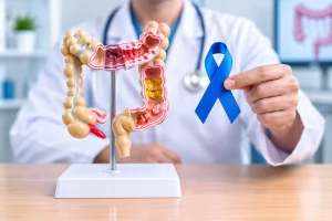 treatment for Colon Cancer In Dubai