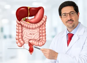 Colon Specialist in Dubai