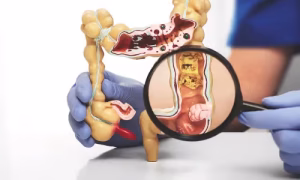 Colorectal Surgery Dubai