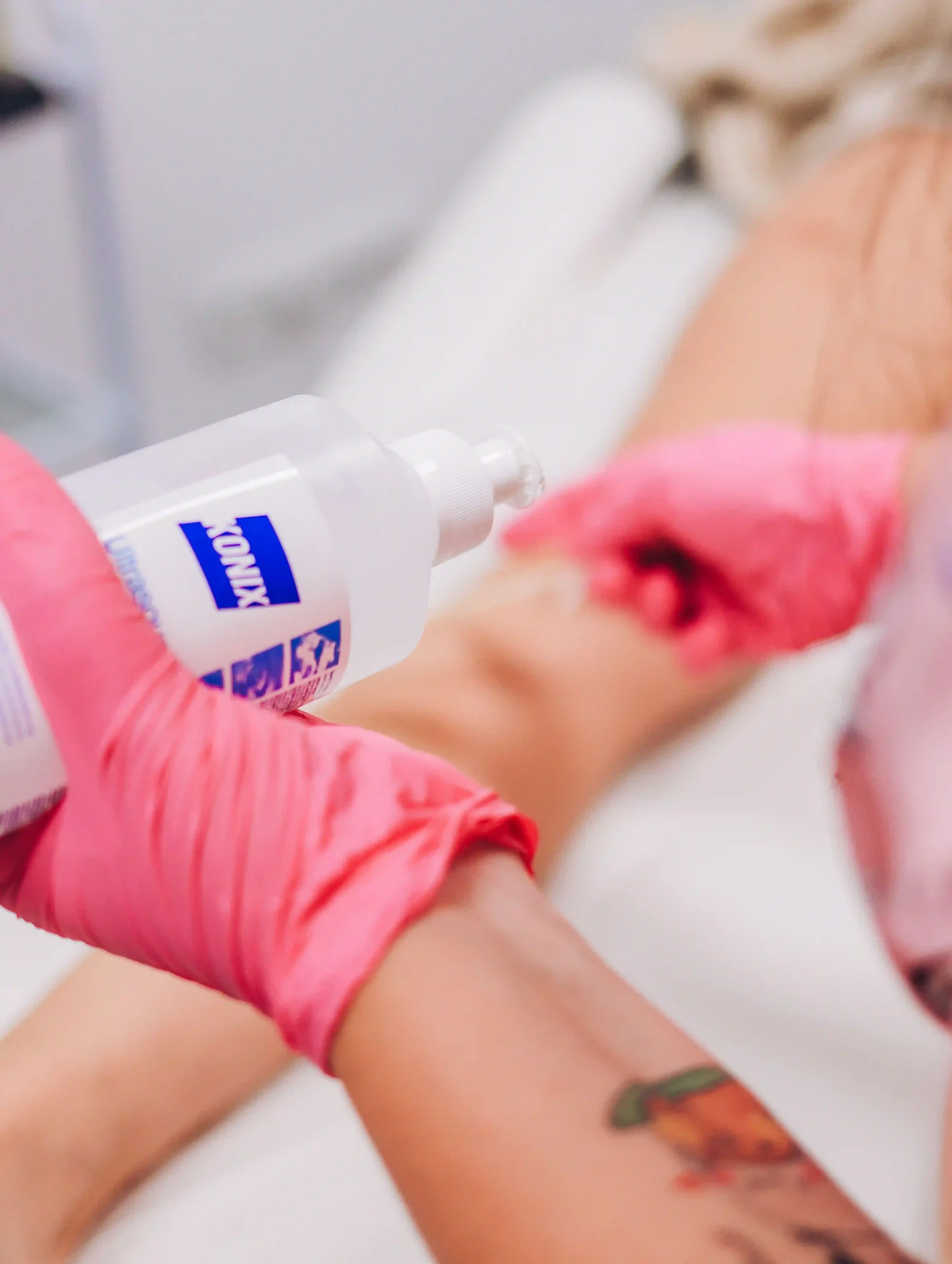 Lipoma treatment in Dubai