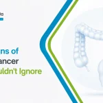 Early Signs of Colon Cancer You Shouldn’t Ignore