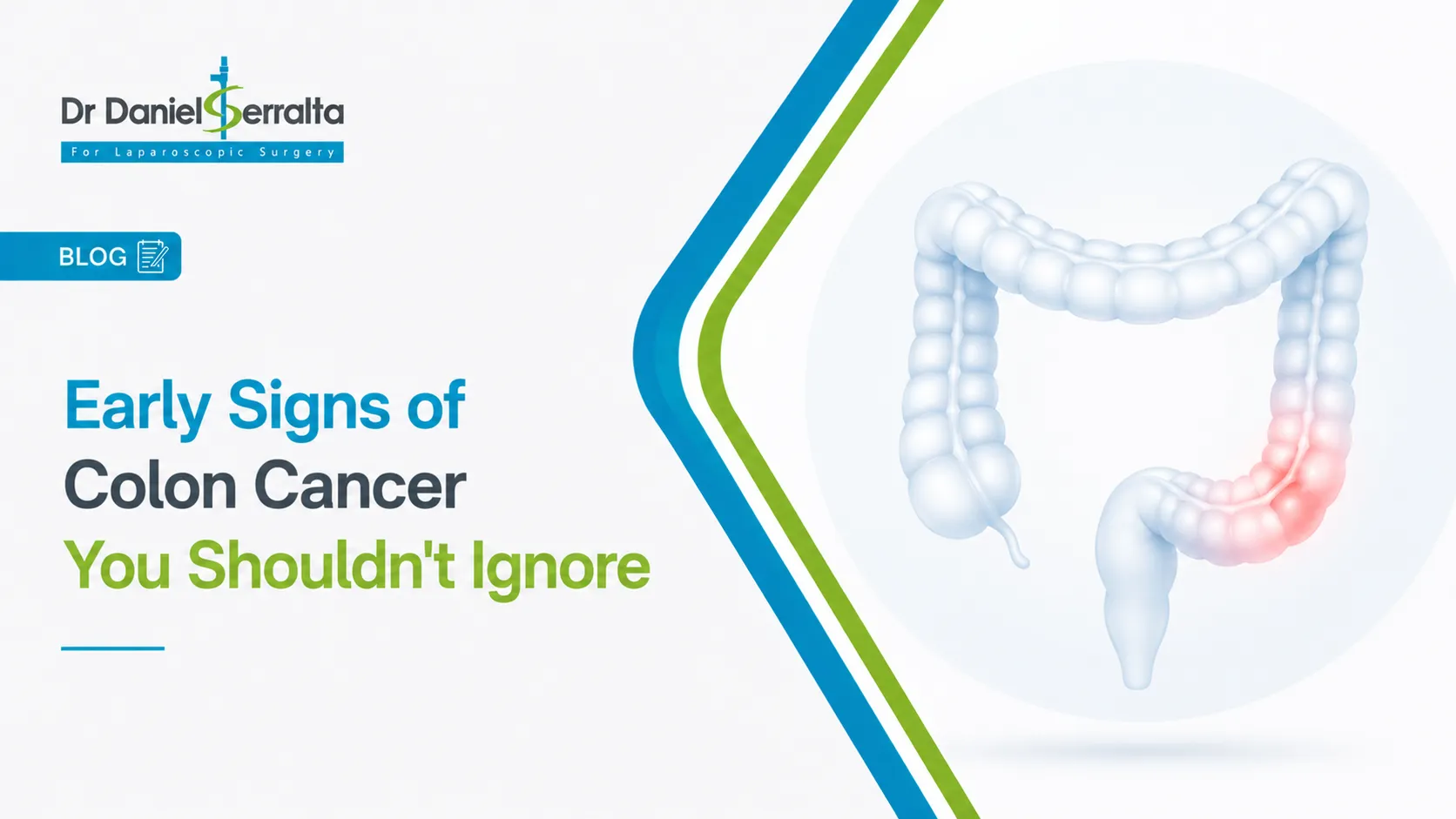 Early signs of colon cancer