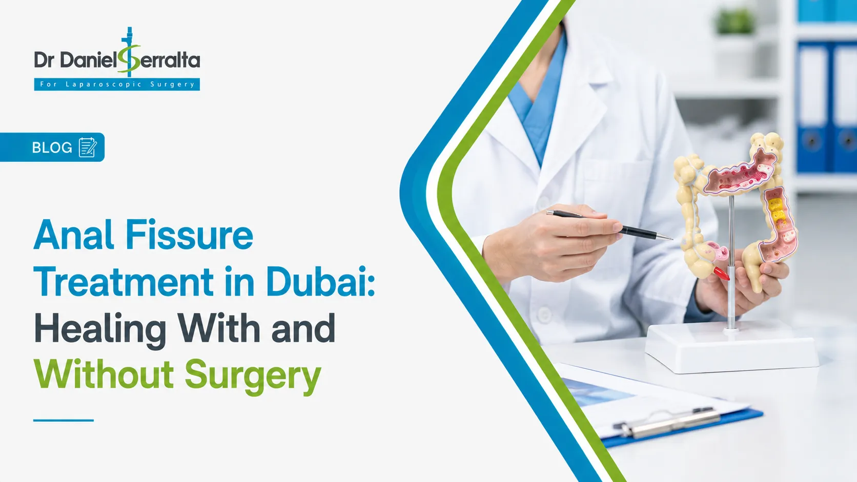 Anal Fissure Treatment in Dubai