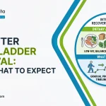 Life After Gallbladder Removal: Diet & What to Expect