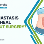 Can Diastasis Recti Heal Without Surgery?