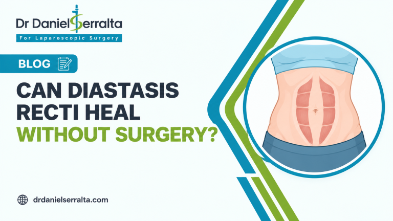 Can Diastasis Recti Heal Without Surgery?